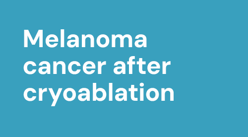 "Melanoma cancer after cryoablation"